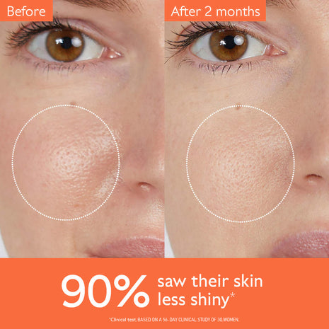 تونر Phofay Watermelon Glow لشد المسام بحمض PHA + BHA