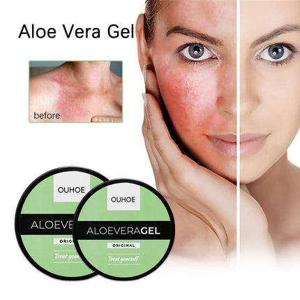 OUHOE Aloe Vera Gel