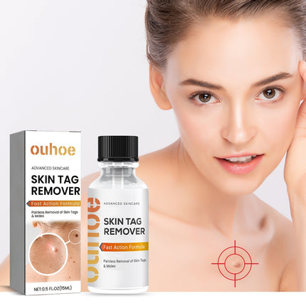 OUHOE Skin Wart Remover