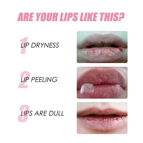 EELHOE Honey Infused Lip Oil
