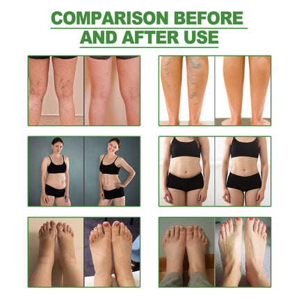 Before and after use comparison of a skin care product on legs, abdomen, and feet.