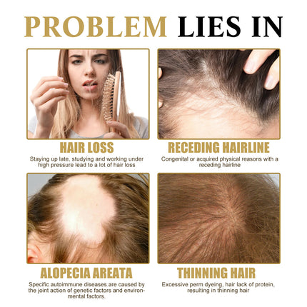 OUHOE Ginseng Scalp Hair Care