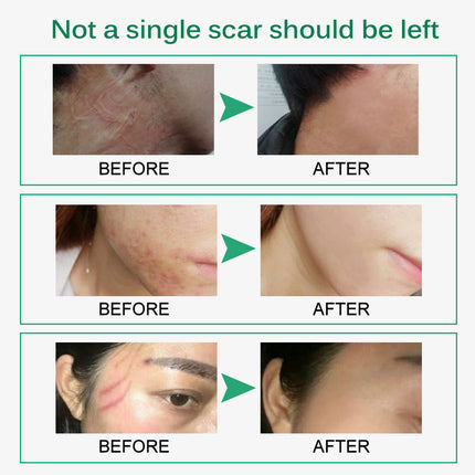 Before and after comparison of skin treatment results with green accents.