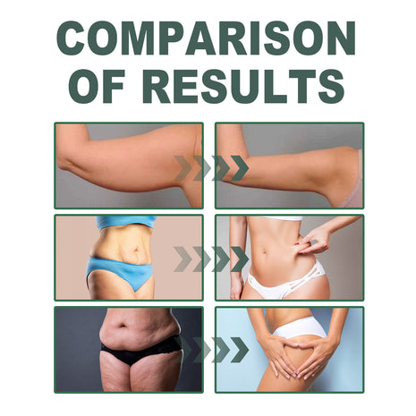 ローズマリーコラーゲンリフティングボディオイル – 保湿引き締めマッサージオイル