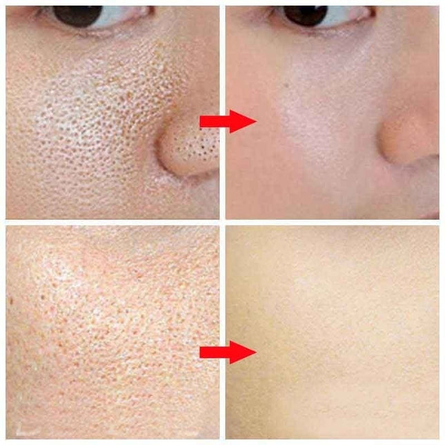 Before and after comparison of skin texture with a red arrow pointing to the difference.