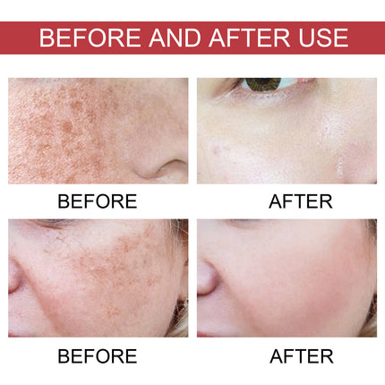 Before and after use comparison of skin treatment on a person's face.