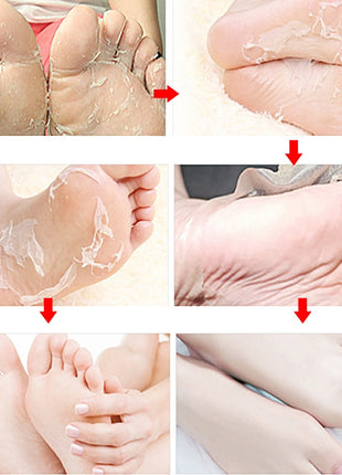 EFERO Mascarilla Exfoliante para Pies | Eliminación de Piel Muerta y Mascarilla Hidratante para los Pies