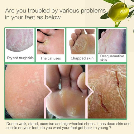 Foot care product advertisement showing foot issues and a plant.
