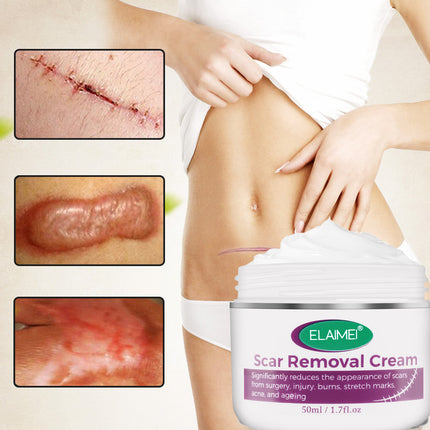 Scar removal cream with before-and-after images of scars on a person's leg.