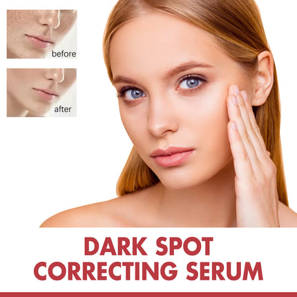 Advertisement for dark spot correcting serum showing a woman's face with before and after effects.