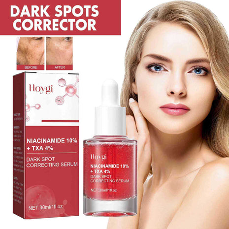 Hoygi Niacinamide 10% + TXA 4% Dark Spot Correcting Serum with packaging and a model showing results.