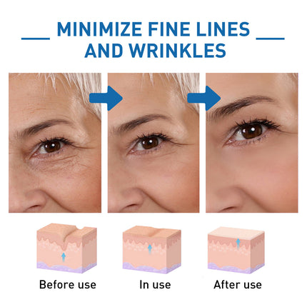 Before and after effect of a skincare product on skin with fine lines and wrinkles.