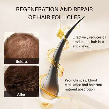 Product advertisement for hair follicle regeneration and repair with before and after images of hair growth.