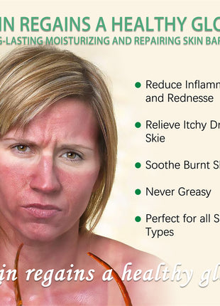 OUHOE Gel de Aloe Vera | Gel calmante, hidratante y para el cuidado de la piel después del sol