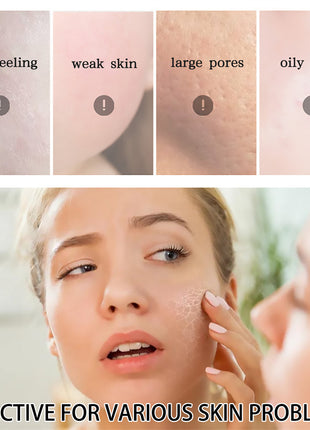 OUHOE Gel de Aloe Vera | Gel calmante, hidratante y para el cuidado de la piel después del sol