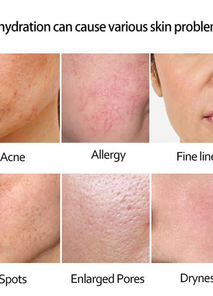 SEHUAR Sérum facial de oro de 24 quilates | Esencia facial hidratante y reafirmante con niacinamida