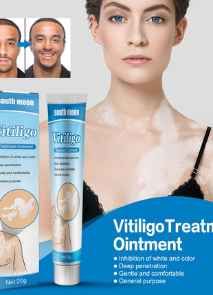 South Moon Crema de Tratamiento para Vitiligo | Crema para el Cuidado Dirigido de la Pigmentación de la Piel