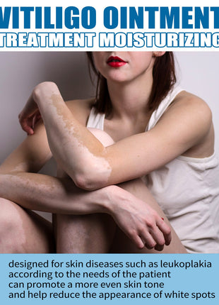 South Moon Crema de Tratamiento para Vitiligo | Crema para el Cuidado Dirigido de la Pigmentación de la Piel