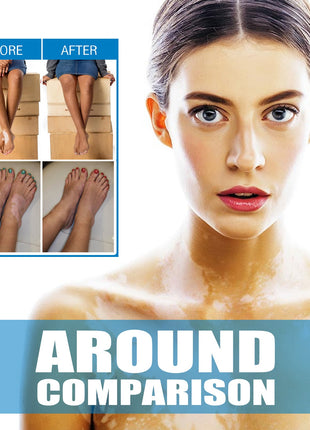 South Moon Crema de Tratamiento para Vitiligo | Crema para el Cuidado Dirigido de la Pigmentación de la Piel