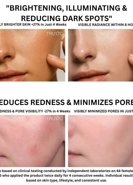 Teashell Niacinamide Brightening Serum | Dark Spot & Tone Care