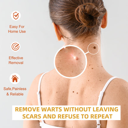 OUHOE Skin Wart Remover