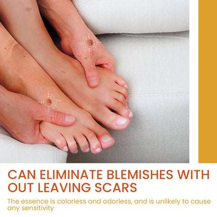 OUHOE Skin Wart Remover