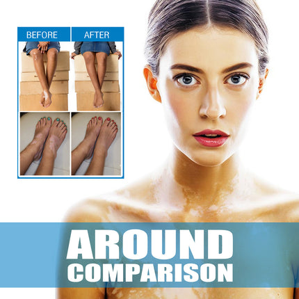 South Moon Skin Spot Removal Cream