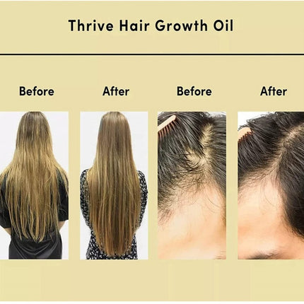 Thrive Rosemary Hair Care Oil