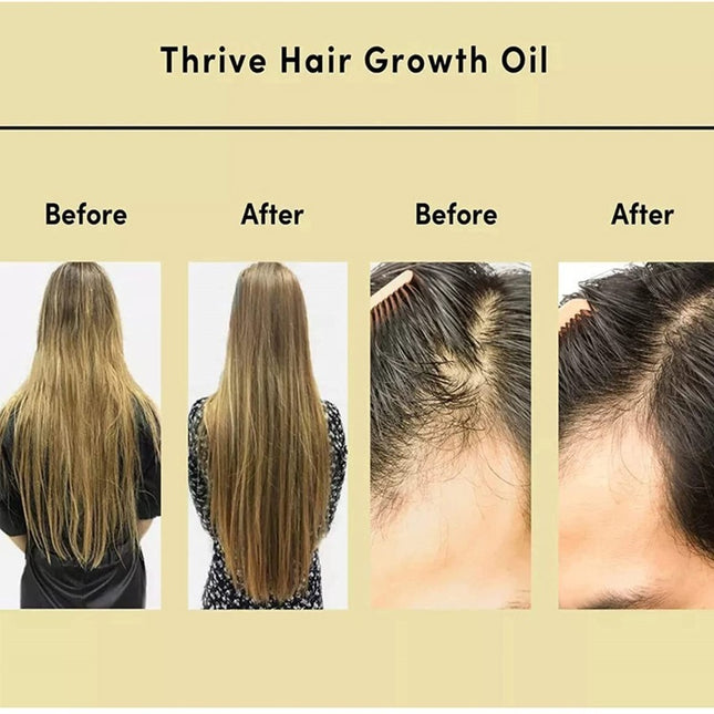 Thrive Rosemary Hair Care Oil