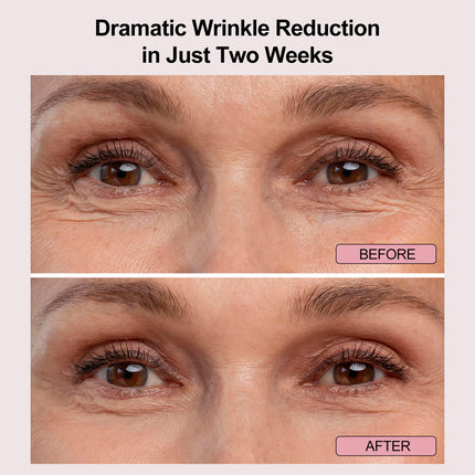 Light Eye Mask Four-color LED technology