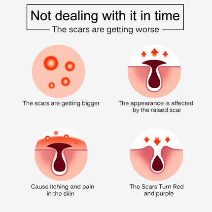 Illustration showing the progression of scars on skin with text indicating worsening and complications.